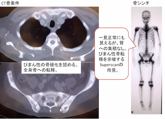 骨・関節の画像診断Ⅰ・Ⅱ2巻揃 | davidsonlawyers.ca